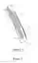 Fig. 06 - Method and Device for Improved Hygiene During Endoscopic Procedures