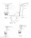 Fig. 08 - Illuminated telescoping cannula