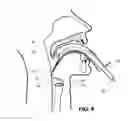 Fig. 09 - Intubating Airway