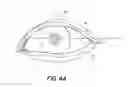 Fig. 06 - Visualization of eye anatomy