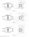 Fig. 11 - METHODS AND DEVICES FOR PROVIDING INFORMATION USEFUL IN THE DIAGNOSIS OF ABNORMALITIES OF THE GASTROINTESTINAL TRACT