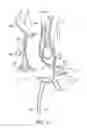 Fig. 13 - System and method for locating neural tissue