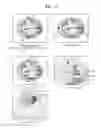 Fig. 03 - METHOD AND APPARATUS FOR INDICATING POINT WHOSE LOCATION HAS BEEN ADJUSTED BASED ON TYPE OF CALIPER IN MEDICAL IMAGE