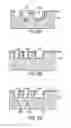 Fig. 11 - Tear fluid conductivity sensor