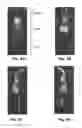 Fig. 07 - SYSTEM AND METHOD OF PRESSURE MAPPING AND 3-D SUBJECT REPOSITIONING FOR PREVENTING PRESSURE WOUNDS