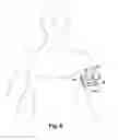 Fig. 08 - Mobile transducer holder assembly