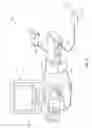 Fig. 05 - Methods and systems for power optimization in a medical device