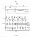 Fig. 11 - Methods and systems for power optimization in a medical device