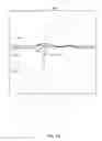 Fig. 27 - Methods and systems for power optimization in a medical device