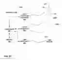 Fig. 24 - Pulse detection using patient physiological signals
