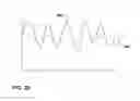 Fig. 26 - Pulse detection using patient physiological signals