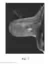 Fig. 02 - CONE BEAM CT IMAGING AND IMAGE-GUIDED PROCEDURES
