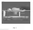 Fig. 04 - CONE BEAM CT IMAGING AND IMAGE-GUIDED PROCEDURES