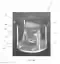 Fig. 09 - CONE BEAM CT IMAGING AND IMAGE-GUIDED PROCEDURES