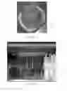 Fig. 17 - CONE BEAM CT IMAGING AND IMAGE-GUIDED PROCEDURES