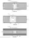 Fig. 05 - COMPUTED TOMOGRAPHY DEVICES, SYSTEMS, AND METHODS
