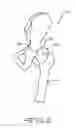 Fig. 03 - Retractor Tool For Minimally Invasive Hip Replacement Surgery