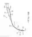 Fig. 12 - Retractor Tool For Minimally Invasive Hip Replacement Surgery