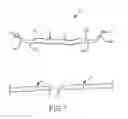 Fig. 02 - METHOD FOR TENDON REPAIR