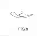 Fig. 08 - METHOD FOR TENDON REPAIR