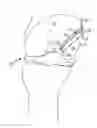 Fig. 01 - SURGICAL FIXATION DEVICE WITH ANTIBACTERIAL SUBSTANCE