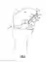 Fig. 04 - SURGICAL FIXATION DEVICE WITH ANTIBACTERIAL SUBSTANCE