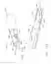 Fig. 98 - Surgical cutting and stapling instruments with independent jaw control features