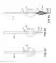 Fig. 23 - Apparatus and methods for fastening tissue layers together with multiple tissue fasteners