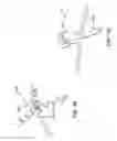 Fig. 41 - Apparatus and methods for fastening tissue layers together with multiple tissue fasteners