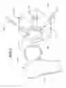 Fig. 03 - Methods and apparatus for determining pin placement during hip surgery