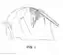 Fig. 02 - Instruments for minimally invasive surgery total knee arthroplasty