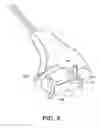 Fig. 05 - Instruments for minimally invasive surgery total knee arthroplasty