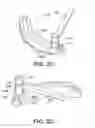 Fig. 07 - Instruments for minimally invasive surgery total knee arthroplasty