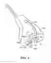 Fig. 08 - Instruments for minimally invasive surgery total knee arthroplasty