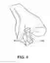 Fig. 10 - Instruments for minimally invasive surgery total knee arthroplasty