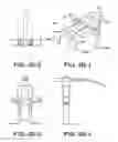 Fig. 12 - Instruments for minimally invasive surgery total knee arthroplasty