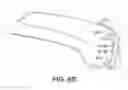 Fig. 16 - Instruments for minimally invasive surgery total knee arthroplasty