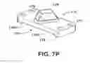 Fig. 20 - Instruments for minimally invasive surgery total knee arthroplasty