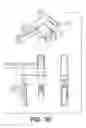 Fig. 40 - Instruments for minimally invasive surgery total knee arthroplasty