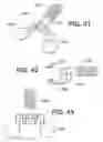 Fig. 46 - Instruments for minimally invasive surgery total knee arthroplasty