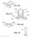 Fig. 47 - Instruments for minimally invasive surgery total knee arthroplasty