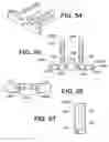 Fig. 50 - Instruments for minimally invasive surgery total knee arthroplasty