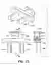 Fig. 55 - Instruments for minimally invasive surgery total knee arthroplasty