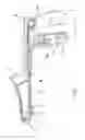 Fig. 02 - Apparatus for treating hemorrhoids