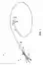 Fig. 02 - FORWARDLY DIRECTED FLUID JET CROSSING CATHETER