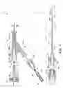 Fig. 04 - FORWARDLY DIRECTED FLUID JET CROSSING CATHETER