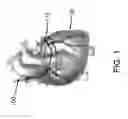 Fig. 02 - Devices, systems, and methods for delivering a substance within a mammalian luminal organ or area adjacent thereto