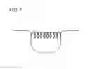 Fig. 07 - FILLING MATERIAL FOR BONE DEFECT PART