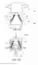 Fig. 07 - Spinal fusion devices and systems