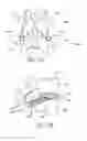 Fig. 08 - Spinal fusion devices and systems